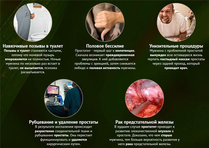 К чему может привести простатит