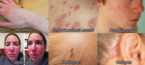 Показания к применению