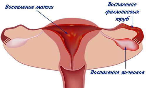 Воспалительные процессы