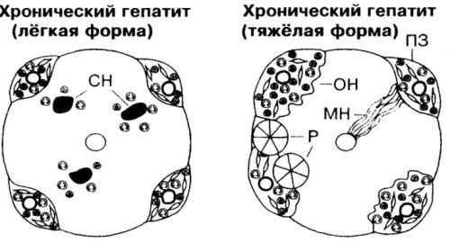 Легкая и тяжелая форма