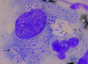 Calymmatobacterium granulomatis