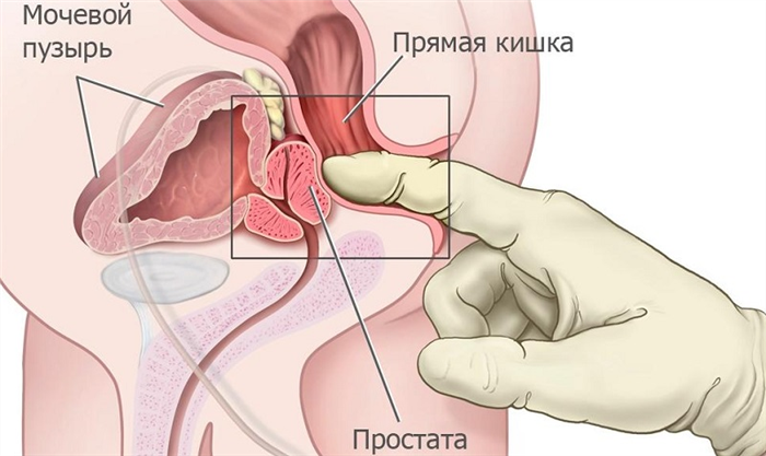 Массаж простаты