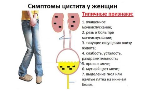 У женщин цистит протекает тяжело, особенно в острой стадии. Болезнь сопровождается спазмами, лихорадкой и ломотой в суставах