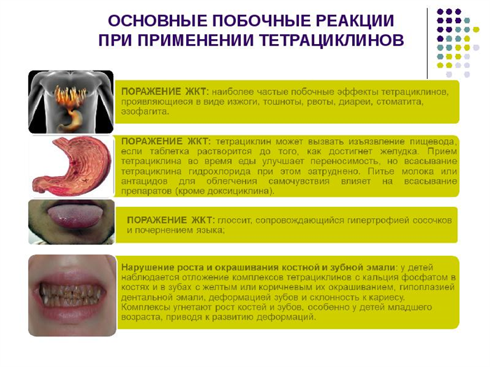 Осложнения при приеме антибиотиков