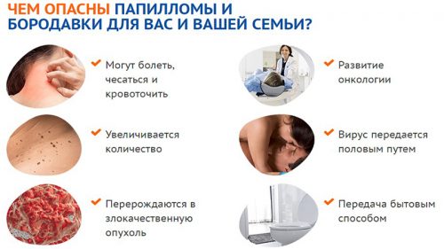 Опасность папиллом и бородавок