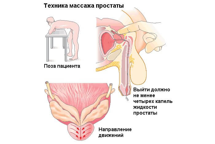 Техника массажа простаты