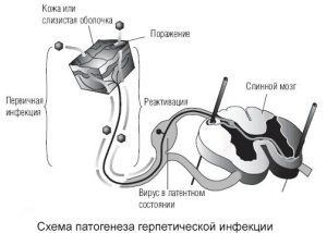 Схема патогенеза герпетической инфекции