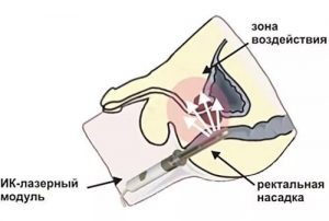 Схема применения