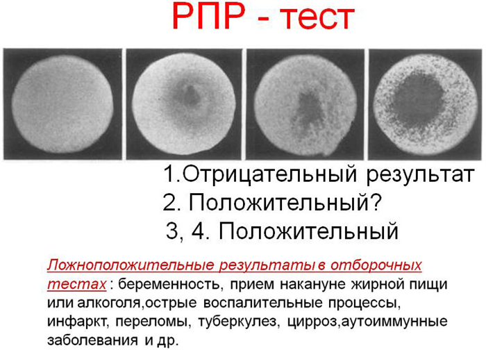 Результаты РПР-теста