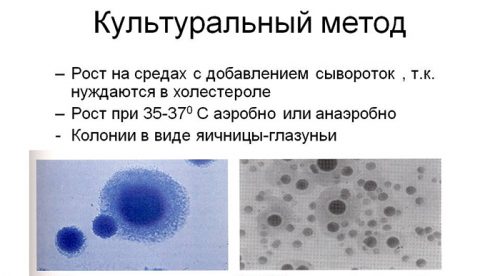 Культуральный метод
