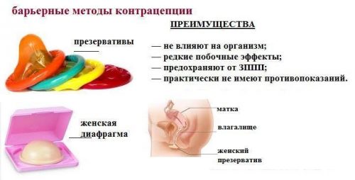 Барьерные методы контрацепции