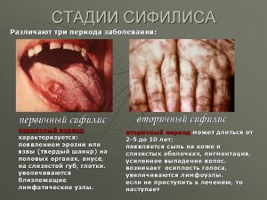 1 и 2 стадии