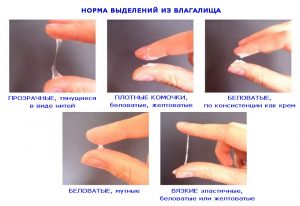 Норма выделений