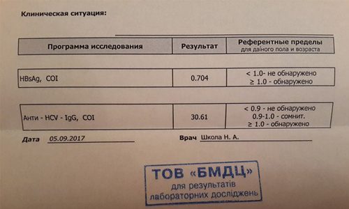 Выявление антител