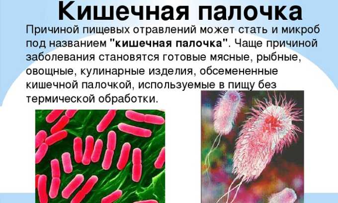 Причиной цистита чаще всего является кишечная палочка, которая всегда имеется в организме человека, но при снижении защитных свойств начинает вредить организму