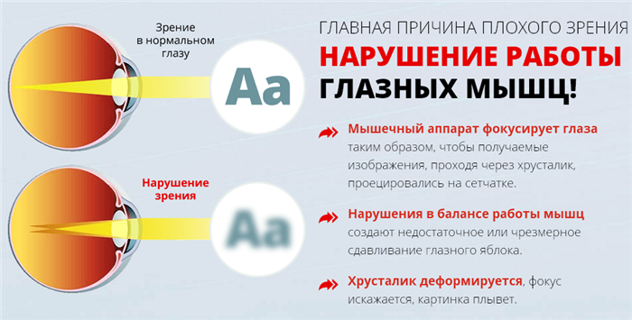 Причина снижения остроты зрения 