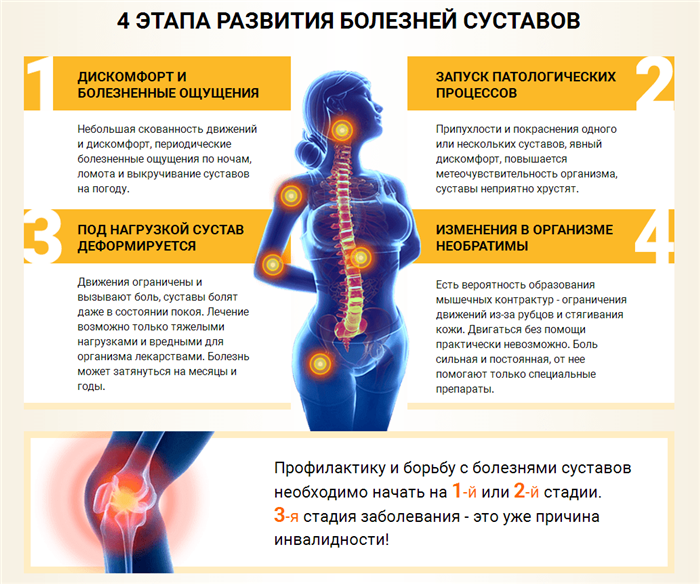 Болезни суставов