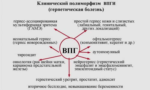 Клинический полиморфизм ВПГИ 