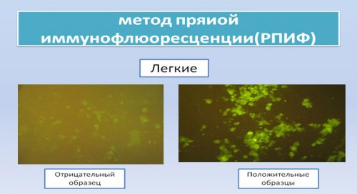 Метод прямой иммунофлуоресценции