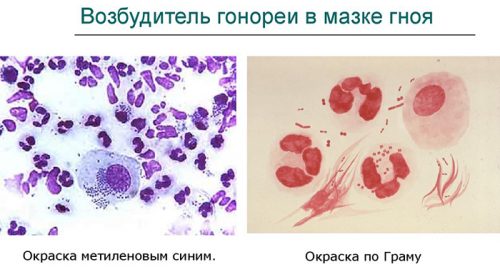 Возбудитель гонореи