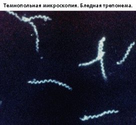 Бледная трепонема