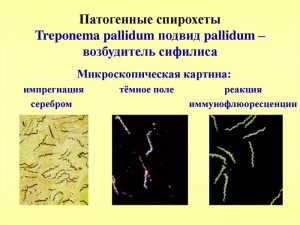 Бледные трепонемы
