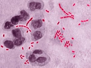 Haemophilus ducreui