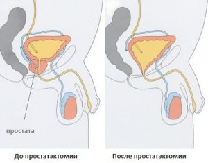 Результаты операции