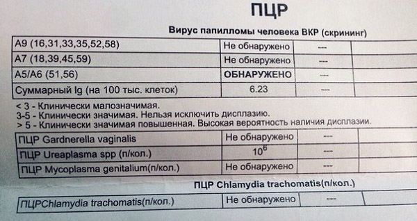 Результат анализа ПЦР