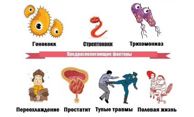 Причины развития цистита