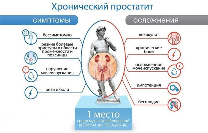 Причины, симптомы и диагностика хронического простатита