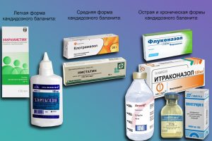 Препараты при разных формах баланита