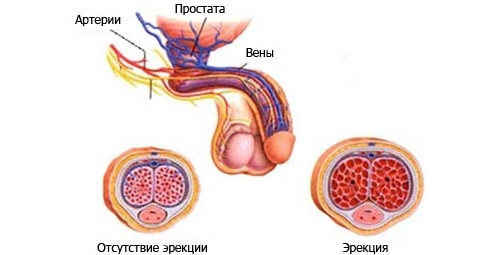 Эректильная дисфункция