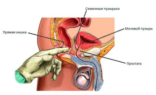 Пальцевое ректальное исследование