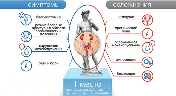 Симптомы простатита