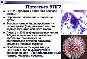 Патогенез ВПГ-2