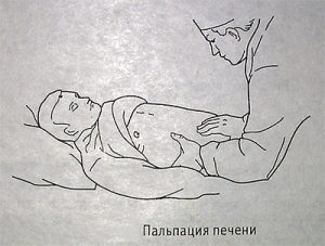 Пальпация печени