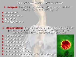 Осложнения хламидиоза