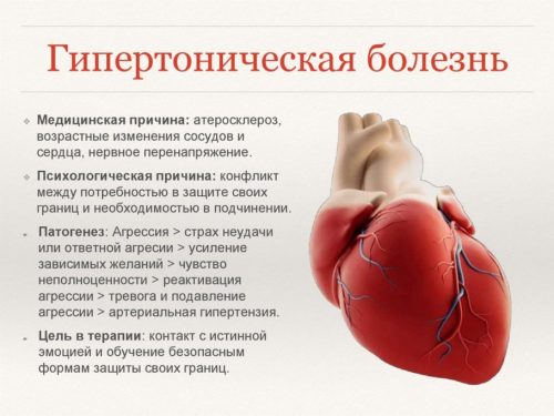 Гипертоническая болезнь