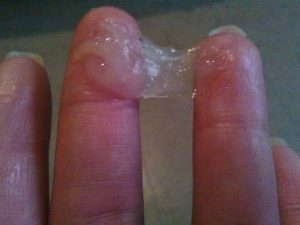 Водянистые прозрачные выделения