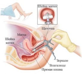 Проведение скрининга