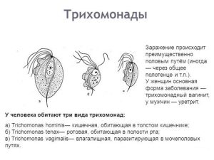 Виды трихомонад