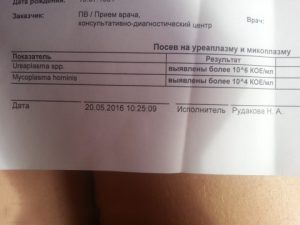 Посев на уреаплазму