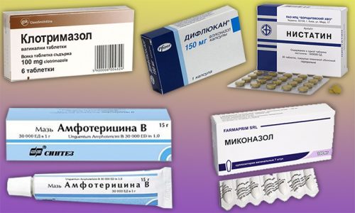 Средства для лечения кандидоза при ВИЧ