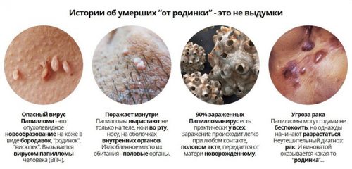 Опасность ВПЧ