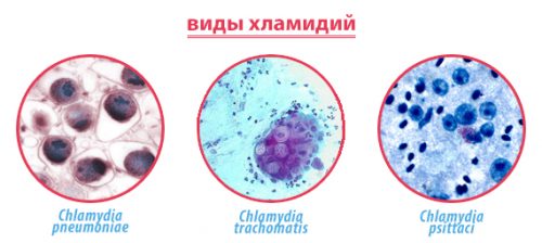 Виды хламидий