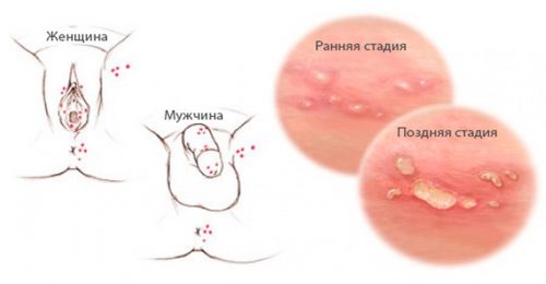 Локализация и стадии