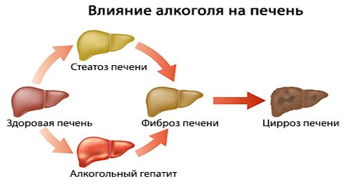 Влияние алкоголя на печень