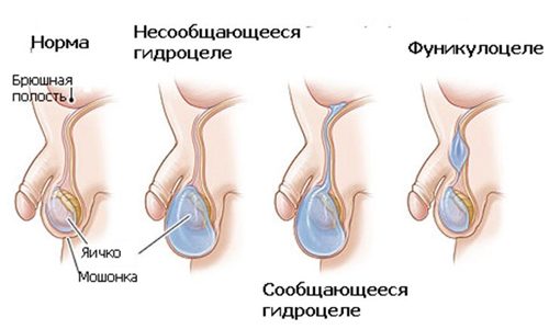 Осложнения заболевания