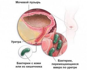 Попадание бактерий